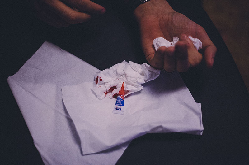wound healing research papers wound healing research papers